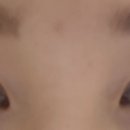 오킴스케이성형외과 이미지
