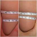 부천 팔뚝관리 추천 더헤르츠스킨 상동본점 엘레강스 암케어 후기