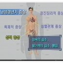 남자의 갱년기 이미지