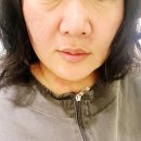 청담동라인한의원 | 청담동 한의원 얼굴 비대칭 교정 후기｜턱관절 문제로 고민하다 3D 스캔 진단 후 1회 치료 변화 기록