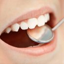 굿보스톤치과의원 이미지