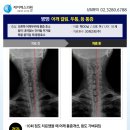 제이에스의원 네이버블로그
