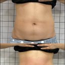 태크니끄 이미지