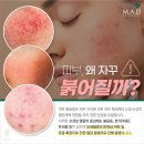 주식회사 라인리스써클 | 피부AS 12월 공구 일정 레스큐 세럼X플라즈마, 탈라 거품토너, (New 컬러출시)아미카 쿠션, 리쥬바이오...