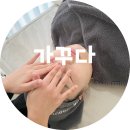 반월당약국 | 대구피부관리 동성로 가꾸다 스킨젝션프로 솔직후기