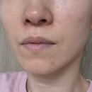 하양 바른온누리약국 | 약국입점템 닥터오라클 피부결세럼 거칠었던 피부결이 달라졌어요