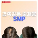 디블랙 | 창원 두피문신 커버 자연스럽게 잘하는곳 디블랙 후기