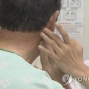 마비