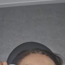 스노우의원대전둔산 네이버블로그
