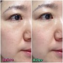 한국바이오초크 - 마포구 동교로 148-12 | [메디코이] 바이오 유브이 프로텍트 레이저 마스터 : 순한 선크림, 저자극 선크림으로 추천