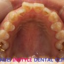 CORE 치과기공소 이미지