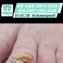 닥터아이티엔챈네일