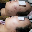 우성세탁소 | 피부트러블에 울어본 사람들 오세요 여드름전문 피부관리실 군포 희에스떼 몇년째 단골