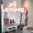 노프레임네일