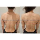 장지동주민센터 | 송파 위례 장지동 다이쁘다 에너지테라피 받고 어깨 불균형 맞춘 후기
