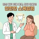 평내호평 임산부 스케일링, "임신 중기, 잇몸에서 피가 쏟아져요" 태아와 산모를 위한 안전한 잇몸 관리