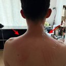 멘소레 | [미리보기] 1년만에 르프로우 통증크림