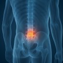 세종365의원 | 세종재활병원 척추 수술 후 단계별 회복 과정