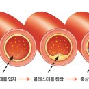 디데이핏 이미지