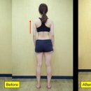 Shoulder Elevation 케이스 이미지