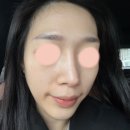 뷰앤플의원 이미지