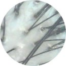 CW메디칼 | 두피 클리닉, 모발 클리닉 / 모발 회복 / 두피 스파 시술 / 창원 상남동 W살롱 💇🏻‍♀️