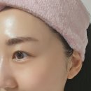 전주웨딩관리 1회만으로 효과 본 비대칭 작은얼굴관리 윤곽관리 샵 추천_약손에스테틱