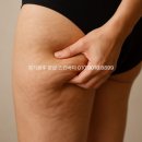 문샵 | 팔ㆍ엉덩이ㆍ복부 셀룰라이트 완전 해결! 경기광주 문샵 스킨바디이 답!