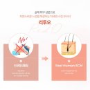 주목주비 | 히알루론산 말고 ECM 시대! 리투오 추천 이유, 후기, 통증, 효과