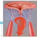 심장판막질환 증세와 치료방법 이미지