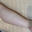 사하구피부관리 엘라인 에스테틱 슬리밍전신관리 후기