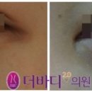 더바디2.0의원 네이버블로그