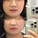[송파구|잠실]잠실윤곽관리 오늘뷰티 에너지테라피 풀페이스 리프팅케어 예신관리 후기