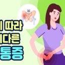 골반염 원인과 통증 치료 왼쪽 허리 골반 통증 골반염 증상일까? 이미지