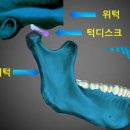 턱관절 통증 원인 및 턱에서 나는 소리 자가진단 방법 이미지