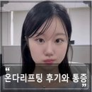 메디큐브의원 | 청담디어의원에서 온다리프팅 6만줄 받은 후기와 통증 강도 및 원리