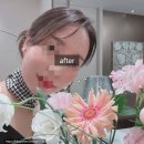 제주냐옹실 고양이미용 | 대구 리투오 스킨부스터 피부과 재방문 찐후기 통증 효과