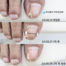장꾸네일 이미지