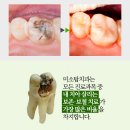 미소탑치과의원 이미지