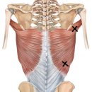 허리통증의 치료사례 - 앉았다 일어날 때, 엎드렸다 일어날 때 왼쪽 통증 이미지