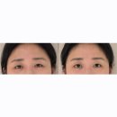 해링턴타워수정1807호 | 강남역 여러분의 얼굴선생님 웨딩관리 윤곽관리 안면비대칭 후기