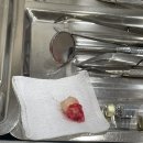 관악연세공감치과의원 네이버블로그