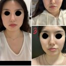 명가한의원 | 쇼호스트💄 | 경략샵 비교분석 솔직후기 (내돈내산) | 약손명가. 리샘한의원. 가인미가. 1인원장샵...