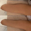 365플러스 의정부신세계점 | 의정부웨딩관리 루비나 피부&amp;바디 3D팔슬리밍관리 내돈내산 후기