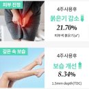 보나데아 궁 Y존케어 실제사용 솔직후기!