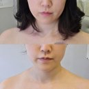 웰발란스메디칼 | [아주르스파] 부산비대칭관리 후기ㅣ윤곽관리 추천