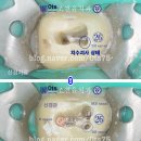 윤치과기공소 이미지