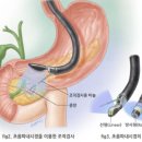 C25 이미지