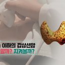 [892회] 생로병사의 비밀/1cm 이하 갑상선암 수술할까? 지켜볼까? 이미지