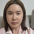 [평택에스테틱]피부 속건조와 홍조가 고민이라면? 아이리안뷰티 오투덤 산소수분관리 후기